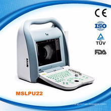 MSLPU22 Scanner d&#39;ultrasons A / B ophtalmique portable numérique complet en Chine